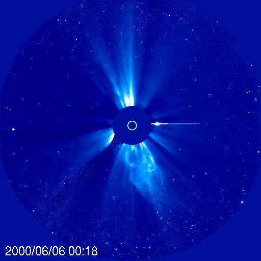 Coronal