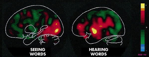 PET (Positron Emission Tomography) Zone diverse del cervello mostrano attività quando si legge