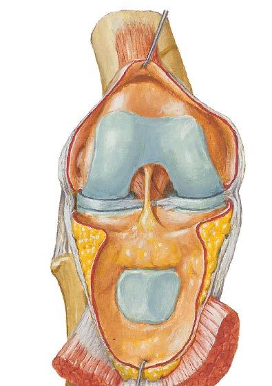 inserzione tendinea