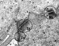 Al microscopio elettronico appaiono come zone elettrondense, localizzate a ridosso della membrana