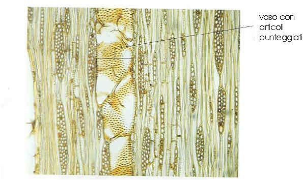 Ogni trachea è costituita da una serie di cellule sovrapposte con forma di larghi e corti cilindri, la