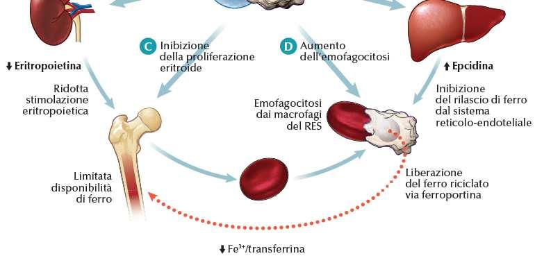 Eventi infettivi e/o infiammatori acuti Anemizzazione: risposta fisiologica Ferro per