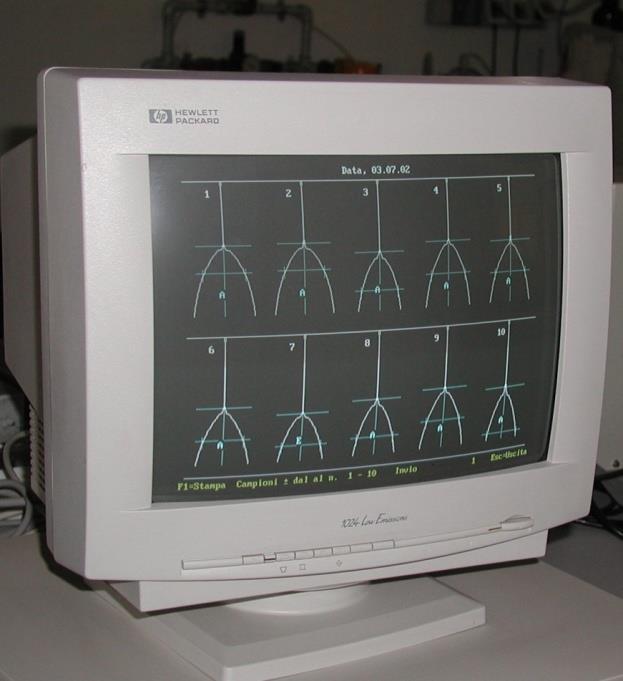 Lactodinamograph -LDG 1 2