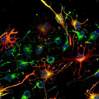 Questa funzione è particolarmente vantaggiosa in caso di più utenti che condividono lo stesso microscopio.