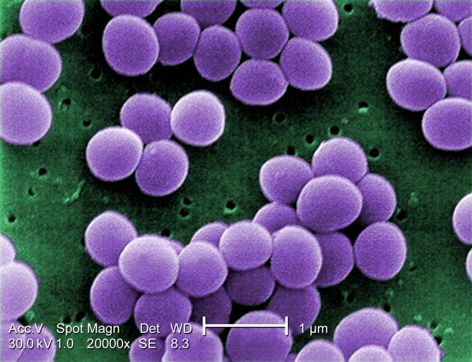 Intossicazione da stafilococco L intossicazione è causata dalle enterotossine prodotte da stafilococchi, di cui il più comune è lo Staphilococcus aureus.