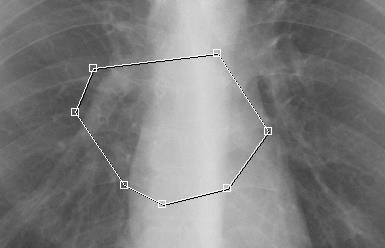 rilasciare il pulsante del mouse. Fare clic sull area interna al rettangolo per spostarlo. Trascinare i punti di controllo per modificare la dimensione del rettangolo. 4 Ellisse: disegna un ellisse.