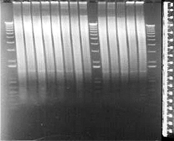 DNA genomico digerito con Enzimi di restrizione gel di agarosio colorato con EtBr Il righello serve per calcolare la lunghezza dei frammenti in funzione dello spazio percorso (cfr.foto succ.