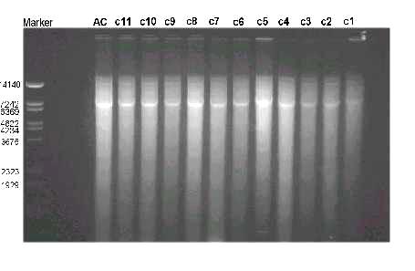 Southern blot (digestione e ibridazione su filtro) DNA genomico