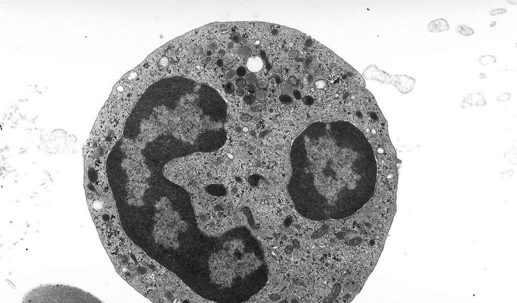 neutrofilo (tem) con la microscopia elettronica, si dimostra che le