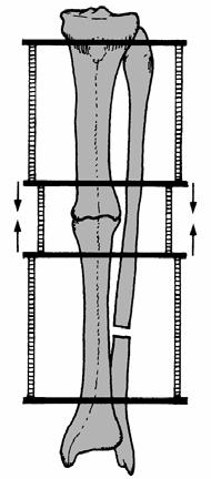 compressiva del montaggio, per non trasformare le forze di