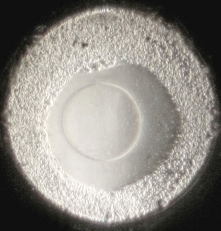 Fig. 2438 Un occhiata alla pupilla d uscita dell obbiettivo (tramite un microscopio ausiliario) mostra effettivamente una zona marginale di aspetto granuloso: olio d immersione risecchito?