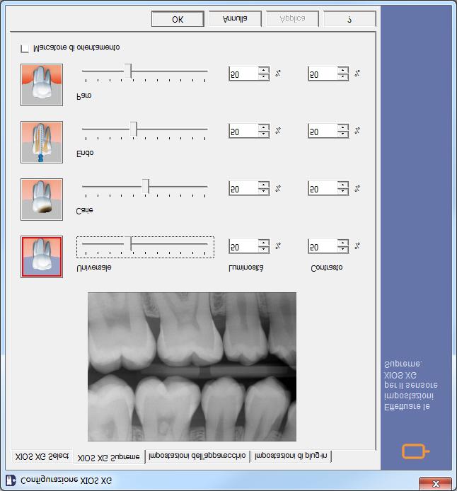 3 Configurazione Sirona Dental Systems GmbH 3.3 Configurazione di XIOS XG Supreme Manuale per l'utente Plugin SIDEXIS per XIOS XG 3.