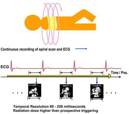 acquisizione dei dati TC durante quelle fasi del ciclo cardiaco Monitoraggio continuo dell