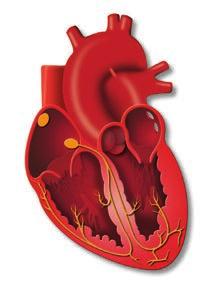 L insufficienza cardiaca L insufficienza cardiaca è una condizione in cui il cuore è incapace di pompare il sangue in tutto il corpo come dovrebbe.
