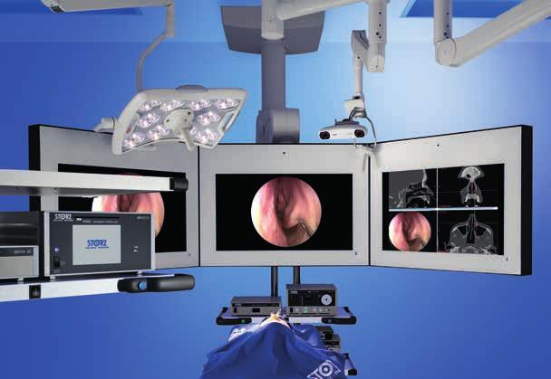 NAV1 optical Il sistema di navigazione ottica per la chirurgia FESS e dell orecchio completamente senza articoli monouso Vantaggi di NAV1 optical Integrazione immediata grazie al posizionamento dell
