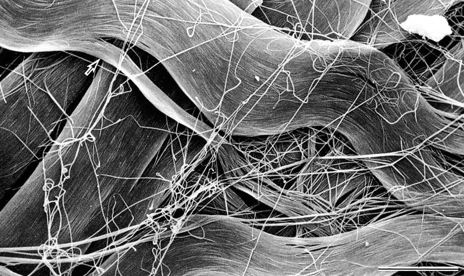 Fasci di fibre collagene (ondulate e a