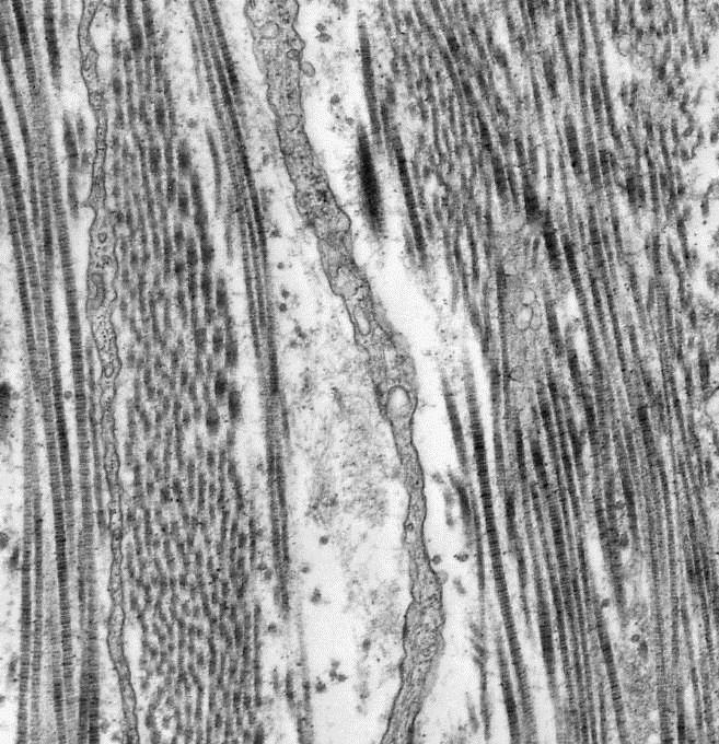 Fibrille di collagene sezionate: A-longitudinalmente