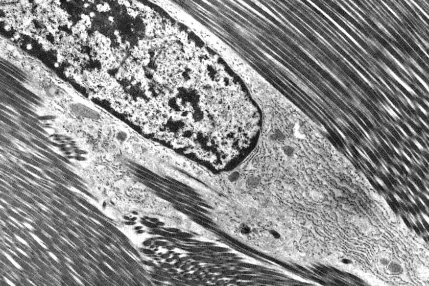 Fibroblasto in fase di