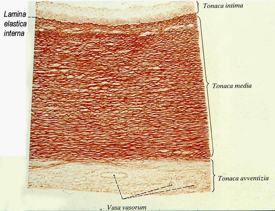 ARTERIA