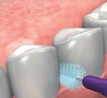 prima dello spazzolino da denti, in questo modo si rimuovono i residui di cibo e la placca batterica infiltratisi negli spazi interdentali, consentendo