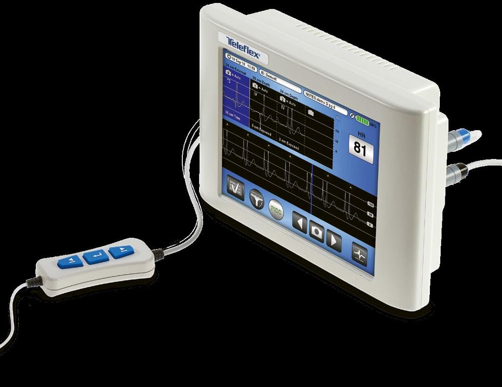 interattivo Consente al clinico di visualizzare facilmente l ECG esterno e intravascolare nonché la