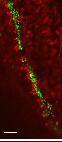 infection at both cellular and whole-plant