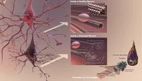 gov/books/nbk28122/figure/a574/ Neurone normale http://scitechdaily.