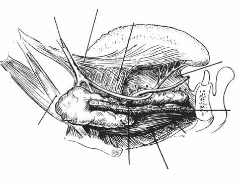 nervo milo-joideo; 9. vena faciale; 0. arteria faciale;. muscolo digastrico (ventre anteriore);. muscolo milo-joideo (rielaborata da Monsen H, 987). 9 6 7 Fig.