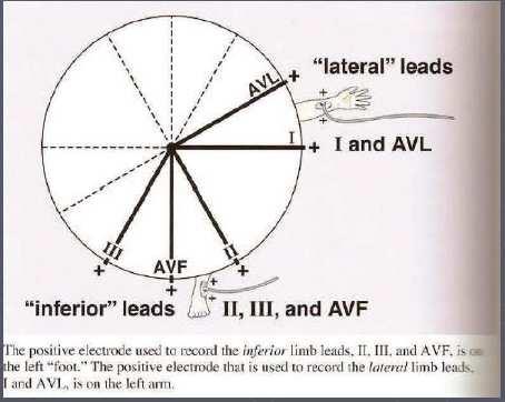Gli elettrodi positivi usati per registrare le derivazioni inferiori sono poste nel piede destro