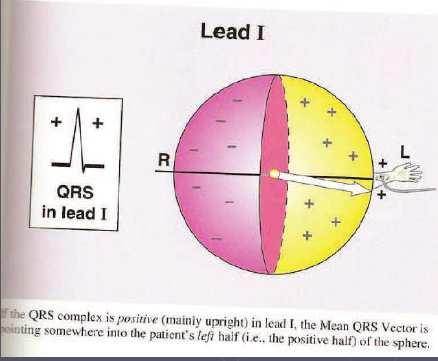 Se il complesso QRS è positivo (diretto verso l alto) nella deriv.