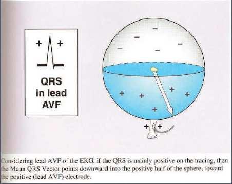 Se sul tracciato in AVF il QRS è prevalentemente positivo allora il vettore medio del QRS