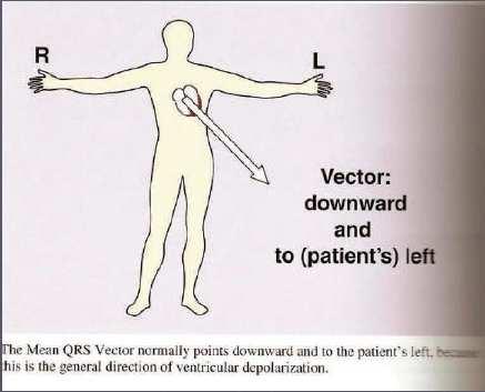 Il vettore medio del QRS normalmente punta verso il basso e verso la