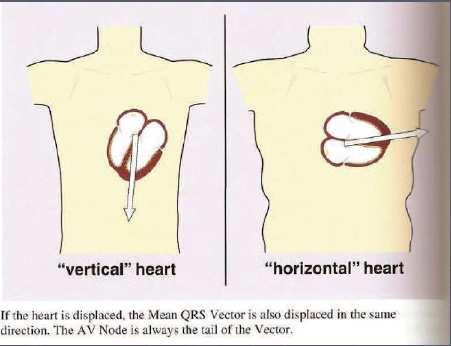 Se il vettore è deviato verticalmente o orrizontalmente anche il vettore medio