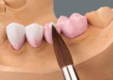 Applicare ora BASE DENTINE del colore desiderato partendo dalla zona cervicale sull'intera forma del dente.