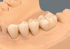 Per la cottura finale molare uniformemente tutta la superficie ed eliminare qualsiasi residuo di polvere.