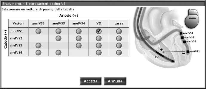 TERAPIE DI STIMOLAZIONE CONFIGURAZIONE DELL'ELETTROCATETERE 4-65 Dispositivi quadripolari Per i dispositivi con una porta per l'elettrocatetere ventricolare sinistro IS4 sono utilizzabili 17