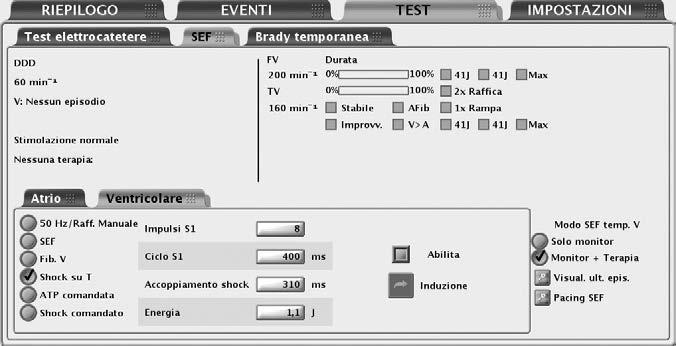 7-2 STUDI ELETTROFISIOLOGICI FUNZIONI S.E.F. FUNZIONI S.E.F. Le funzioni degli Studi Elettrofisiologici (S.E.F.) consentono l induzione e l interruzione non invasiva delle aritmie al fine di monitorare e testare l efficacia dei criteri di riconoscimento e delle terapie selezionati.