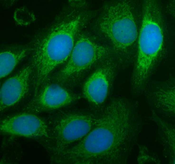 Sui campioni positivi localizza la fluorescenza: NUCLEARE o CITOPLASMATICA