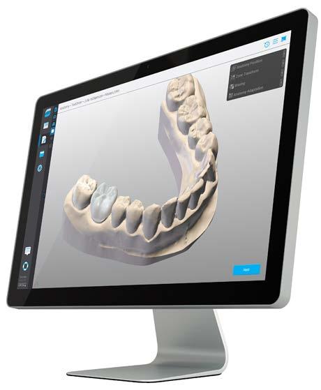 CHAIRSIDE CAD SOLUZIONE PER I DENTISTI Progettato per fornire ai dentisti una soluzione di