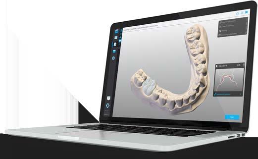 Basato su un decennio di sviluppo di sistemi CAD per i laboratori odontotecnici, il software