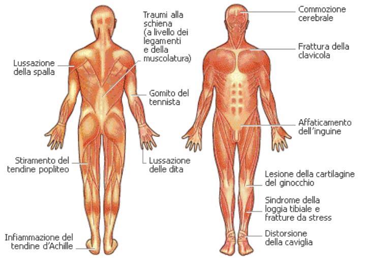 Da contatto Da non contatto Di seguito una immagine che identifica i principali distretti corporei interessati da infortuni sportivi Nel Rugby gli infortuni statisticamente più rilevanti sono: -