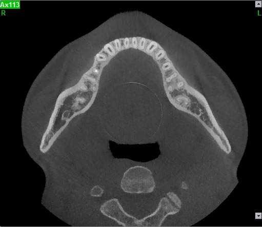 Per l uso di acquisizioni CBCT è necessario rispettare rigorosamente le indicazioni cliniche specifiche. IV.