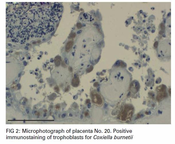Patologia Cellule target: monociti e macrofagi ( granuloma) I ruminanti sono spesso portatori