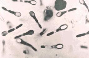 (2) (1) la spora viene prodotta all'interno del batterio intorno al DNA poi la spora viene espulsa dal batterio rompendo la parete