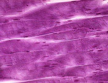 (intensa e discontinua), bassa concentrazione di Ca ++ Pochi mitocondri, metabolismo glicolitico