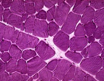 bianche Fibre Intermedie: Condividono parte delle proprietà di entrambi Nei mammiferi i muscoli