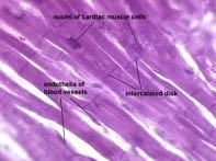 o binucleate 85 x 15 µm (cardiomiociti), nucleo centrale Ramificati e