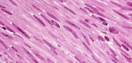 Tessuto muscolare liscio Muscolo liscio Tonaca muscolare di organi cavi (digerente,