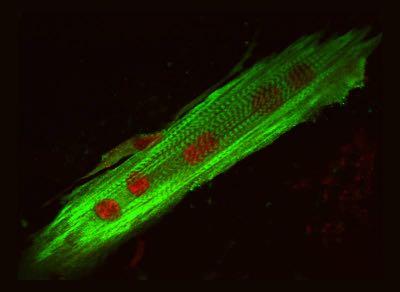 Tessuto muscolare striato scheletrico FIBRA MUSCOLARE (unità cellulare) -Sincizio polinucleato: fusione