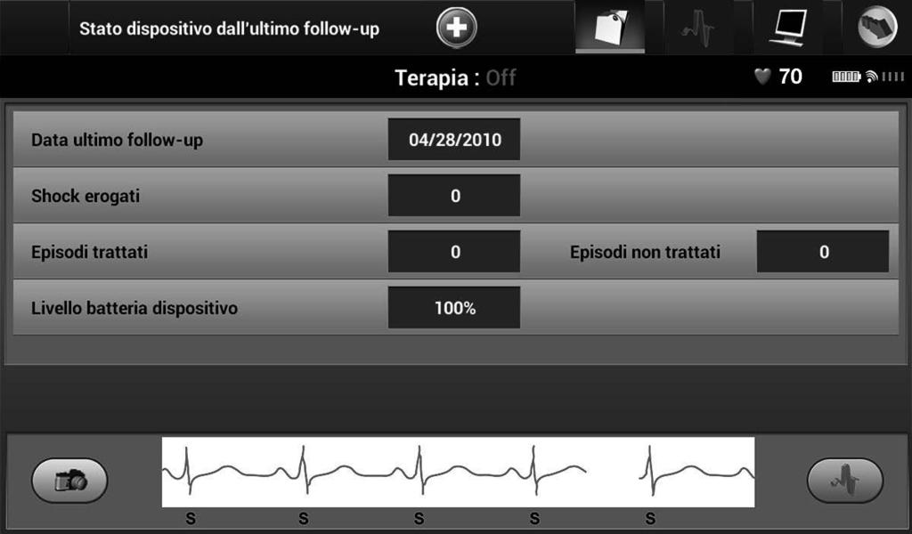 Per visualizzare le informazioni: FUNZIONAMENTO DEL PROGRAMMATORE Q-TECH TM 1. Selezionare il pulsante Menu principale. 2. Selezionare il pulsante Monitoraggio. 3.